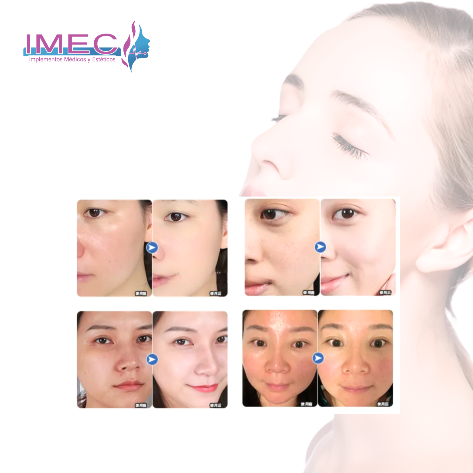 imec
